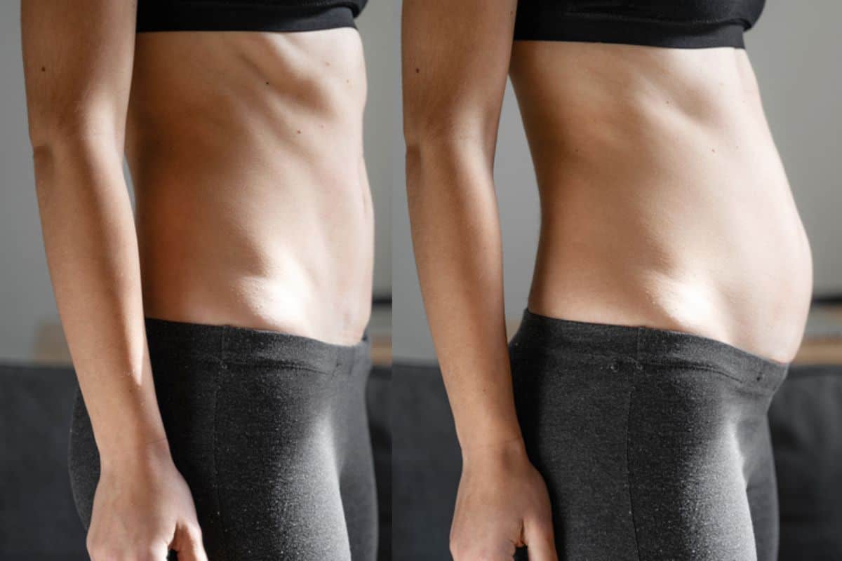 How long does diastasis recti take to improve Rochdale?