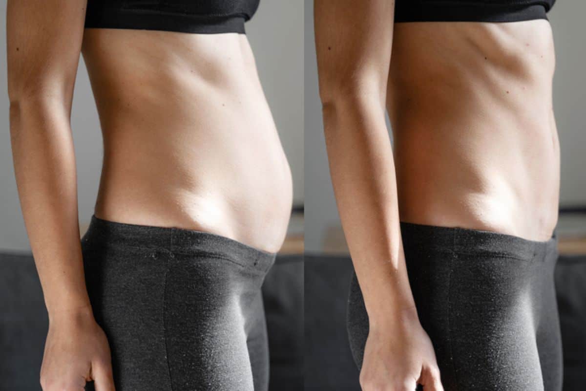 Post-Pregnancy: What Happens to Your Abdominal Muscles After Birth Rochdale
