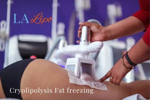 women getting fat freezing Rochdale