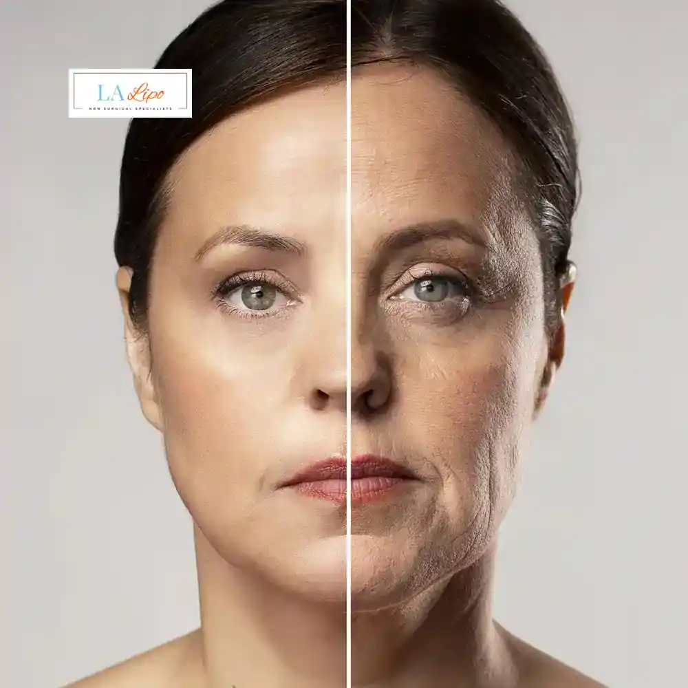 How Can You Tell If Non-Surgical Skin Tightening Is Right for You Rochdale?