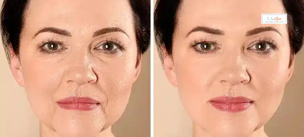 Why Aren’t My Skincare Products Making My Sagging Skin Look Firmer Rochdale?