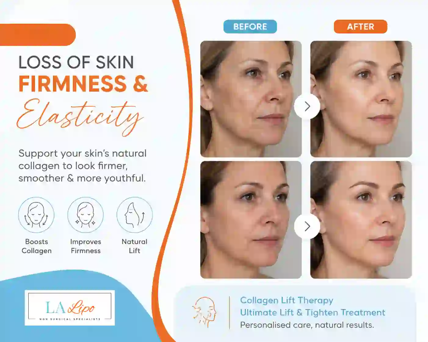 Sign #7: Loss of Skin Firmness and Elasticity Rochdale